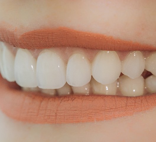 Close-up of smile improved by porcelain veneers