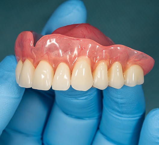 Dentist holding dentures