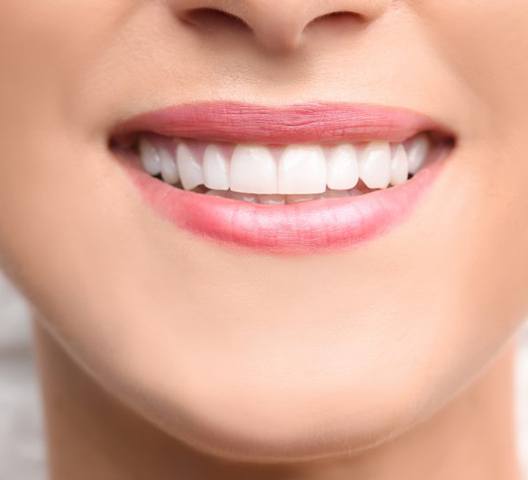 a person smiling after undergoing cosmetic bonding