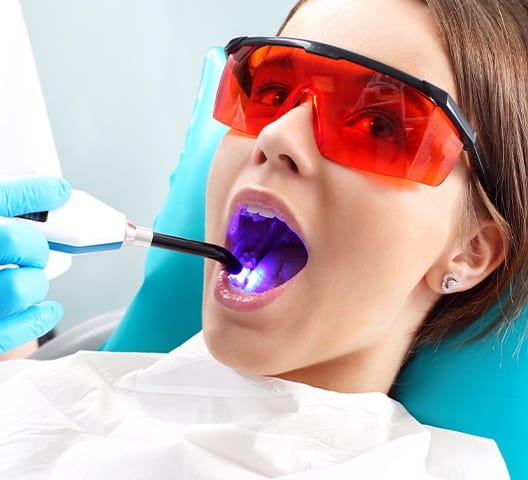 Young girl receiving dental sealants