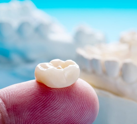 A tooth-colored crown resting on a fingertip