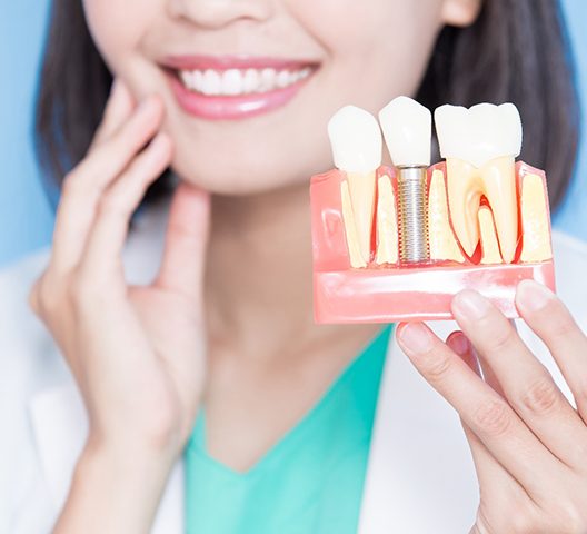 dentist smiling while holding dental implant model