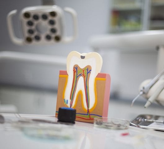 Model of the inside of tooth before root canal therapy
