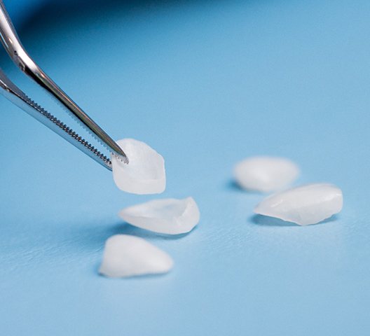 Porcelain veneers being carefully placed on blue surface