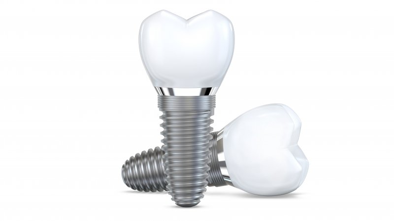 Concept art of two dental implants