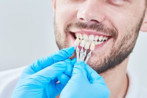 a dentist holding up color matching tools to a patient's teeth